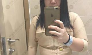 丰胸自体脂肪填充危害 自体脂肪隆胸专家